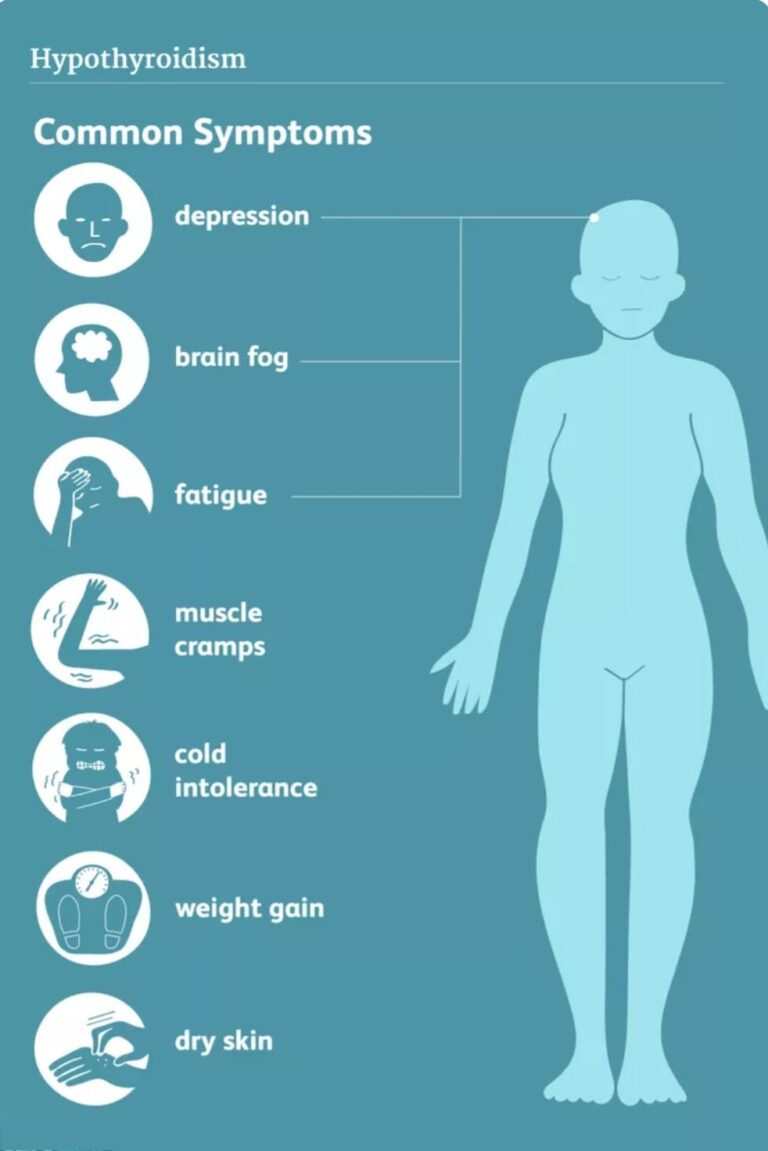 תת פעילות של בלוטת התריס